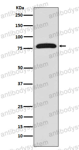 Anti-TGM2 Antibody (R1R91)