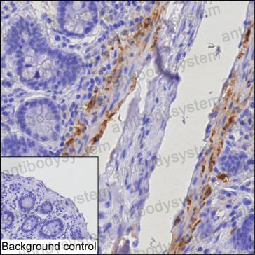 Anti-TGM2 Antibody (R3G03)