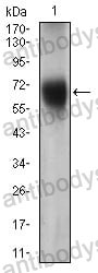 Anti-CD15/FUT4 Antibody (R3G05)
