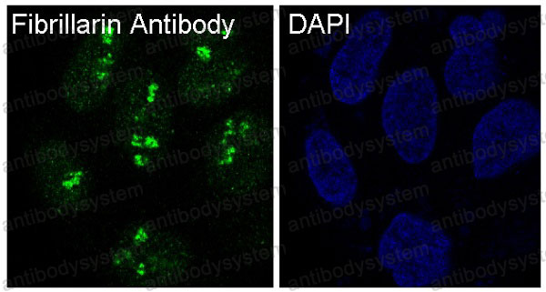 Anti-FBL Antibody (R1C30)