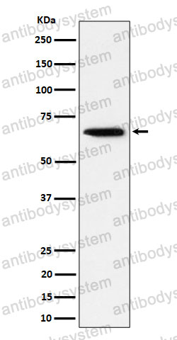 Western blot for Anti-SCP2 Antibody (R1R99) ?>
