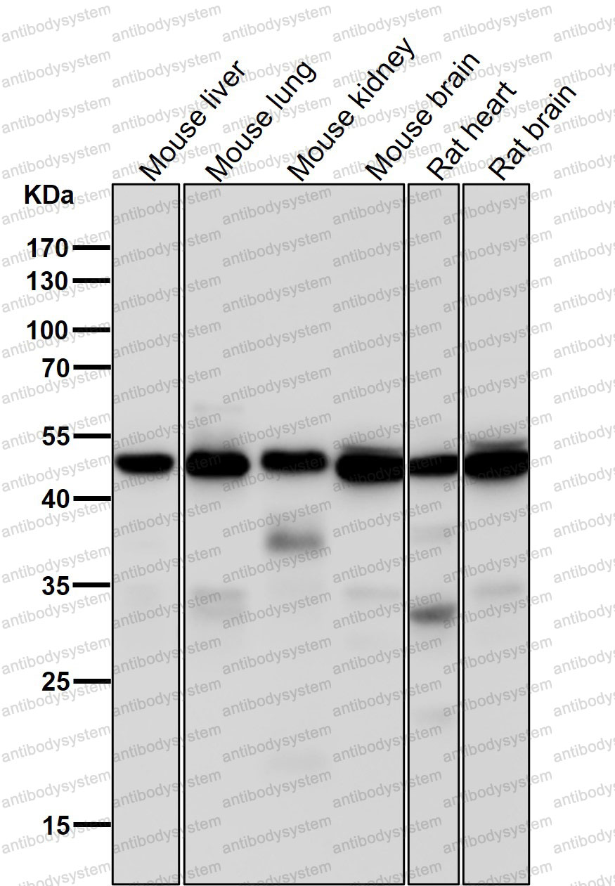 Anti-TUBG1 Antibody (R1B59)