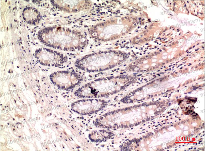 Anti-TUBG1 Antibody (R3G26)