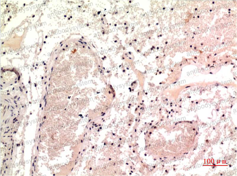 Anti-TUBG1 Antibody (R3G27)