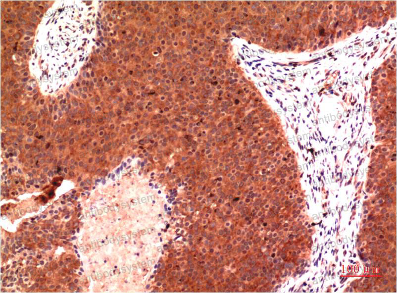 Anti-TUBG1 Antibody (R3G28)
