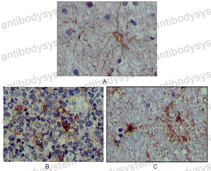 Anti-S100A1 Antibody (R3G31)