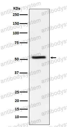Anti-WARS1 Antibody (R1S33)