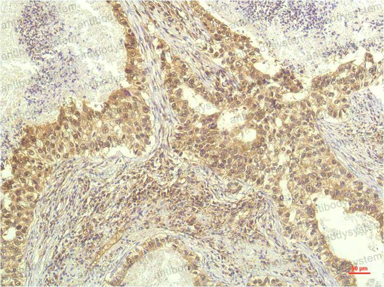 Anti-S6K1/RPS6KB1 Antibody (R3G33)