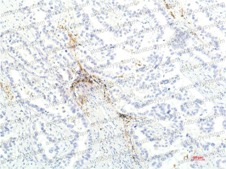 Anti-JAK1 Antibody (R3G34)
