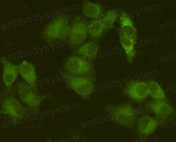 Anti-JAK1 Antibody (R3G36)
