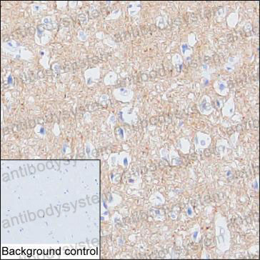 Anti-VAMP1 Antibody (R3G42)