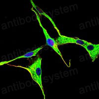Anti-GRK2 Antibody (R3G70)