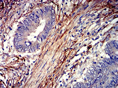Anti-F2R/PAR1 Antibody (R3G72)
