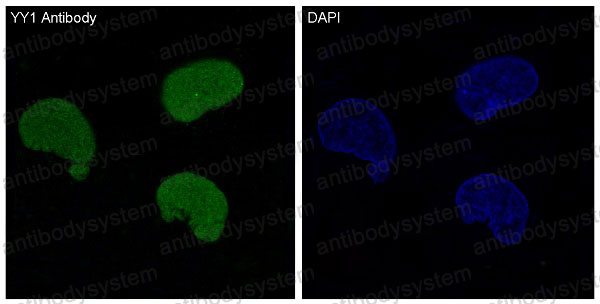 Anti-YY1 Antibody (R1A72)