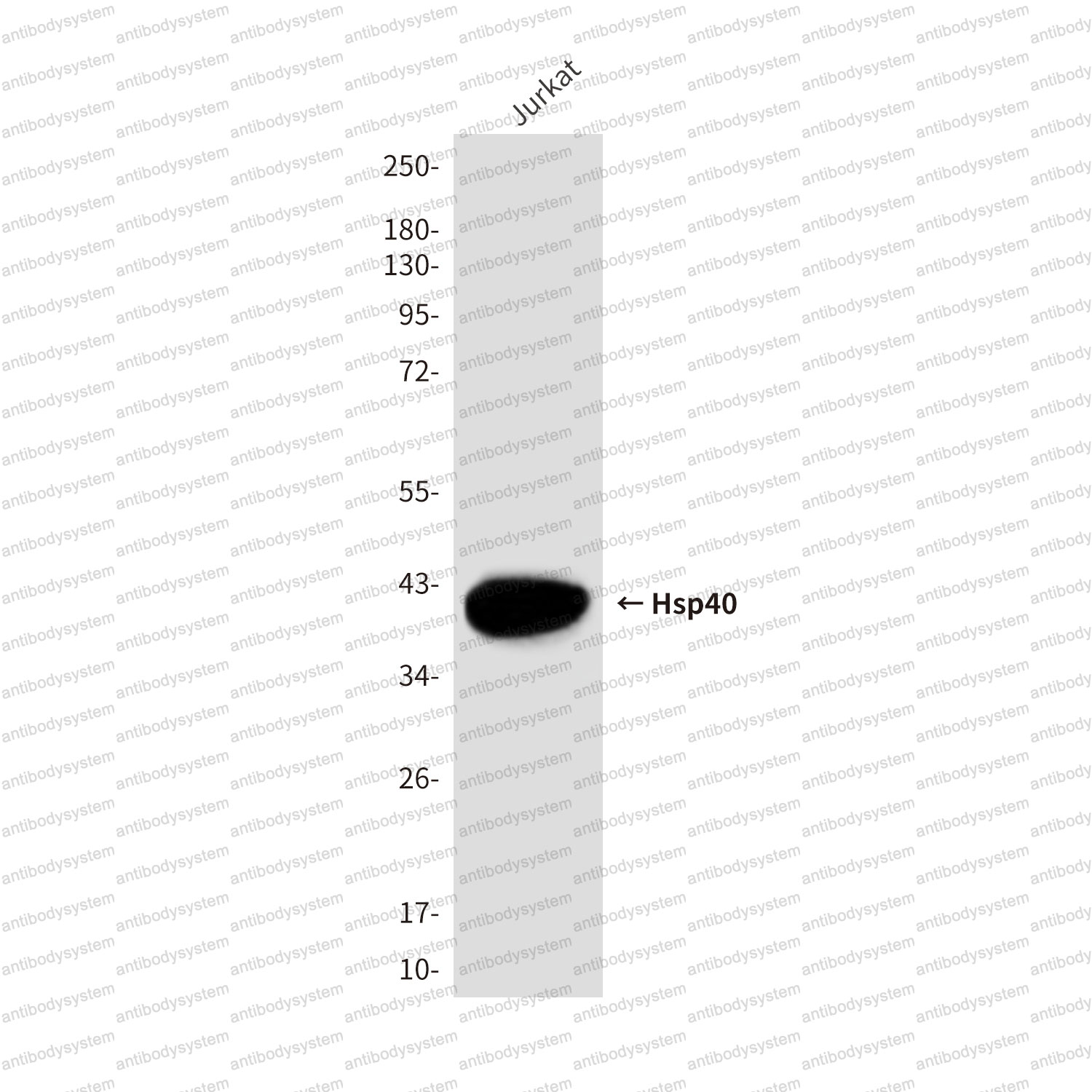 Anti-HSP40/DNAJB1 Antibody (R3G78)