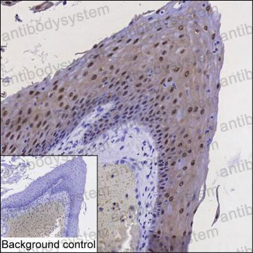 Anti-HSP40/DNAJB1 Antibody (R3G77)
