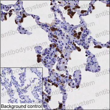 Anti-CTSS Antibody (R3G83)