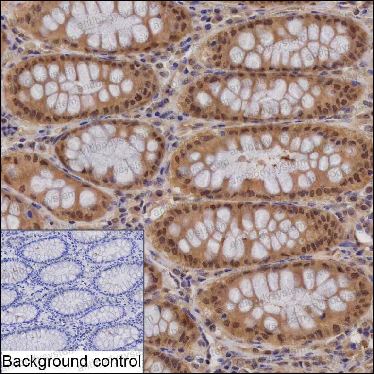 Anti-PSMA1 Antibody (R3G84)