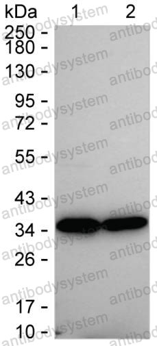 Anti-PSMA1 Antibody (R3G85)