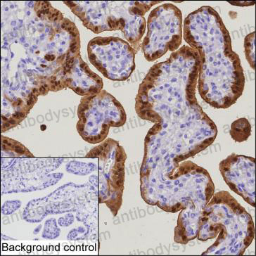 Anti-S100P Antibody (R3G87)