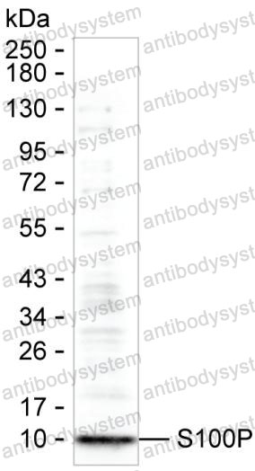 Anti-S100P Antibody (R3G88)