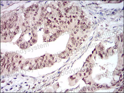 Anti-DNMT1 Antibody (R3H03)
