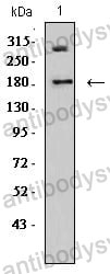 Anti-DNMT1 Antibody (R3H04)