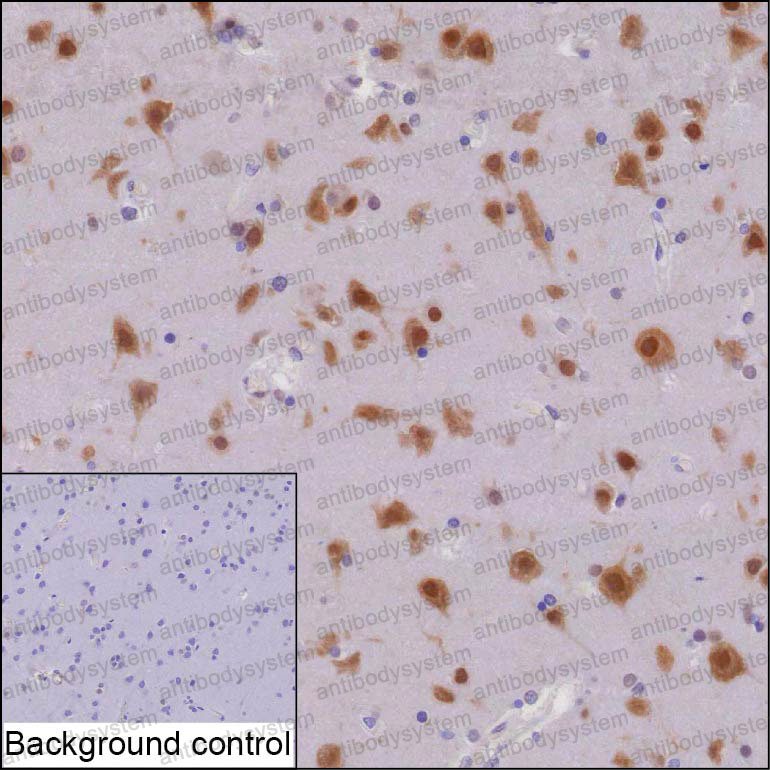 Anti-ELAVL4/HuD/Hu-antigen D Antibody (R3H08)