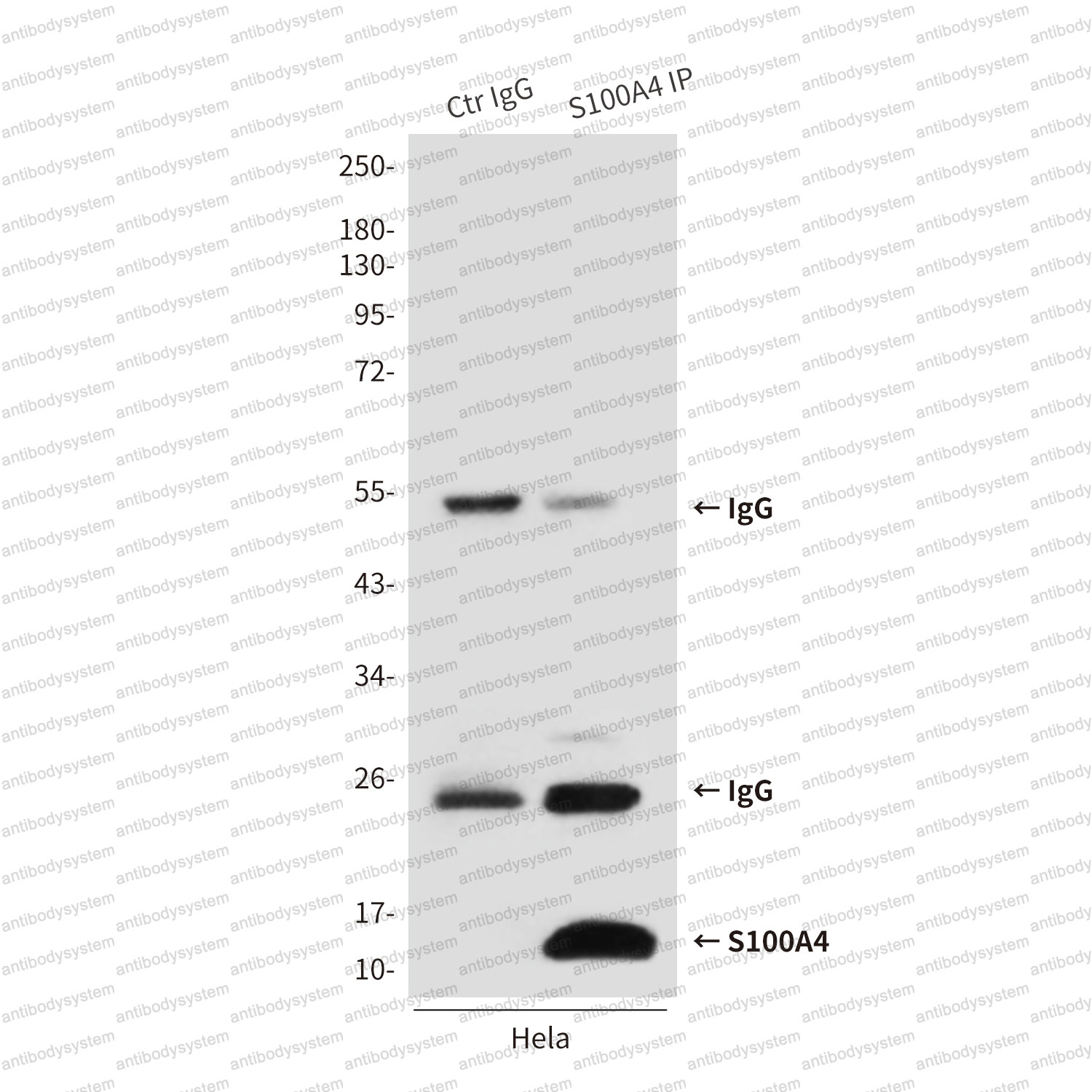 Anti-S100A4 Antibody (R3H13)