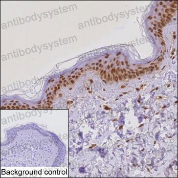 Anti-ZFP36 Antibody (R3H15)