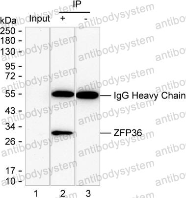 Anti-ZFP36 Antibody (R3H14)
