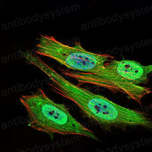 Anti-PON1 Antibody (R3H22)