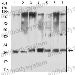 Anti-YWHAQ Antibody (R3H23)