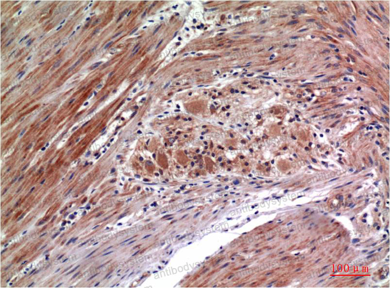 Anti-Phospho-ERK1/2 (Tyr222/Tyr205) Antibody (R3H25)