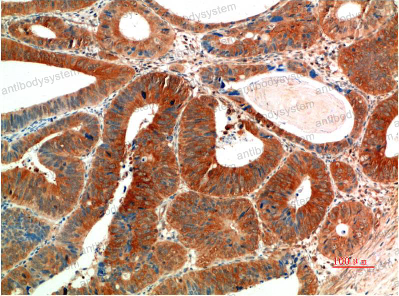 Anti-Phospho-ERK1/2 (Tyr222/Tyr205) Antibody (R3H26)