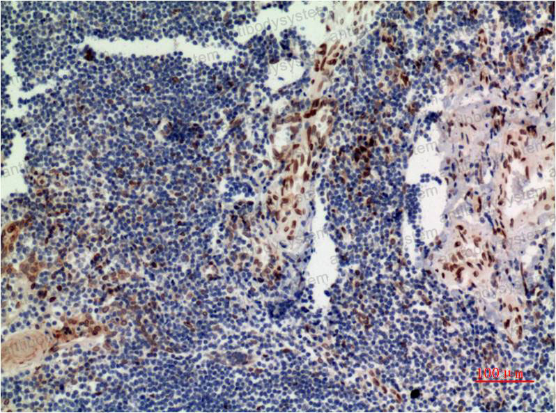 Anti-MAPK3/ERK1 Antibody (R3H29)