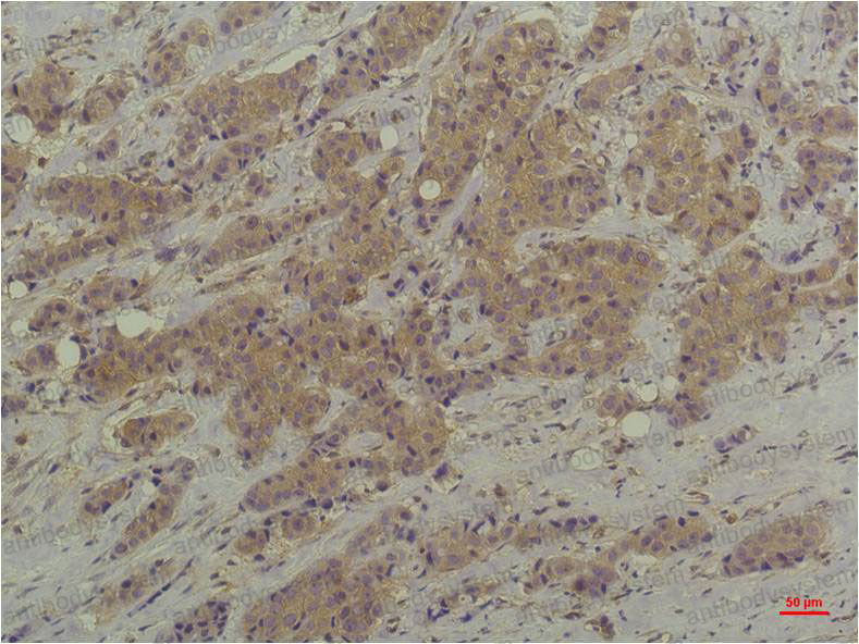Anti-ERK1/2 Antibody (R3H31)