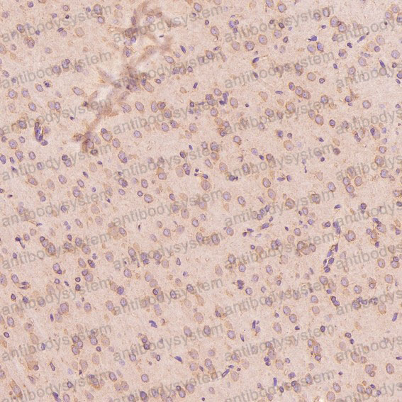 Anti-Calreticulin/CALR Antibody (R1B38)