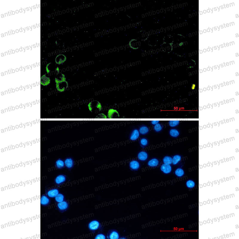 Anti-PIK3R1/PI3-kinase p85-alpha Antibody (R1T41)