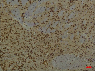 Anti-PIK3R1/PI3-kinase p85-alpha Antibody (R3H48)