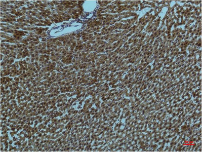 Anti-PIK3R1/PI3-kinase p85-alpha Antibody (R3H49)