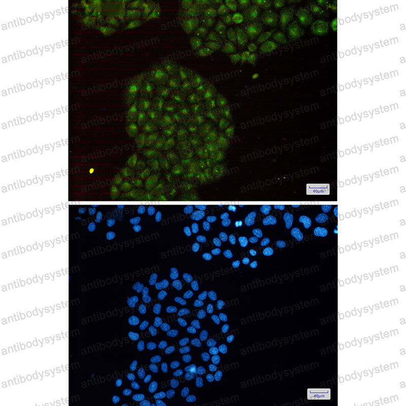 Anti-PSMB8 Antibody (R1T42)