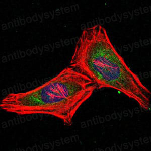 Anti-PSMB8 Antibody (R3H50)