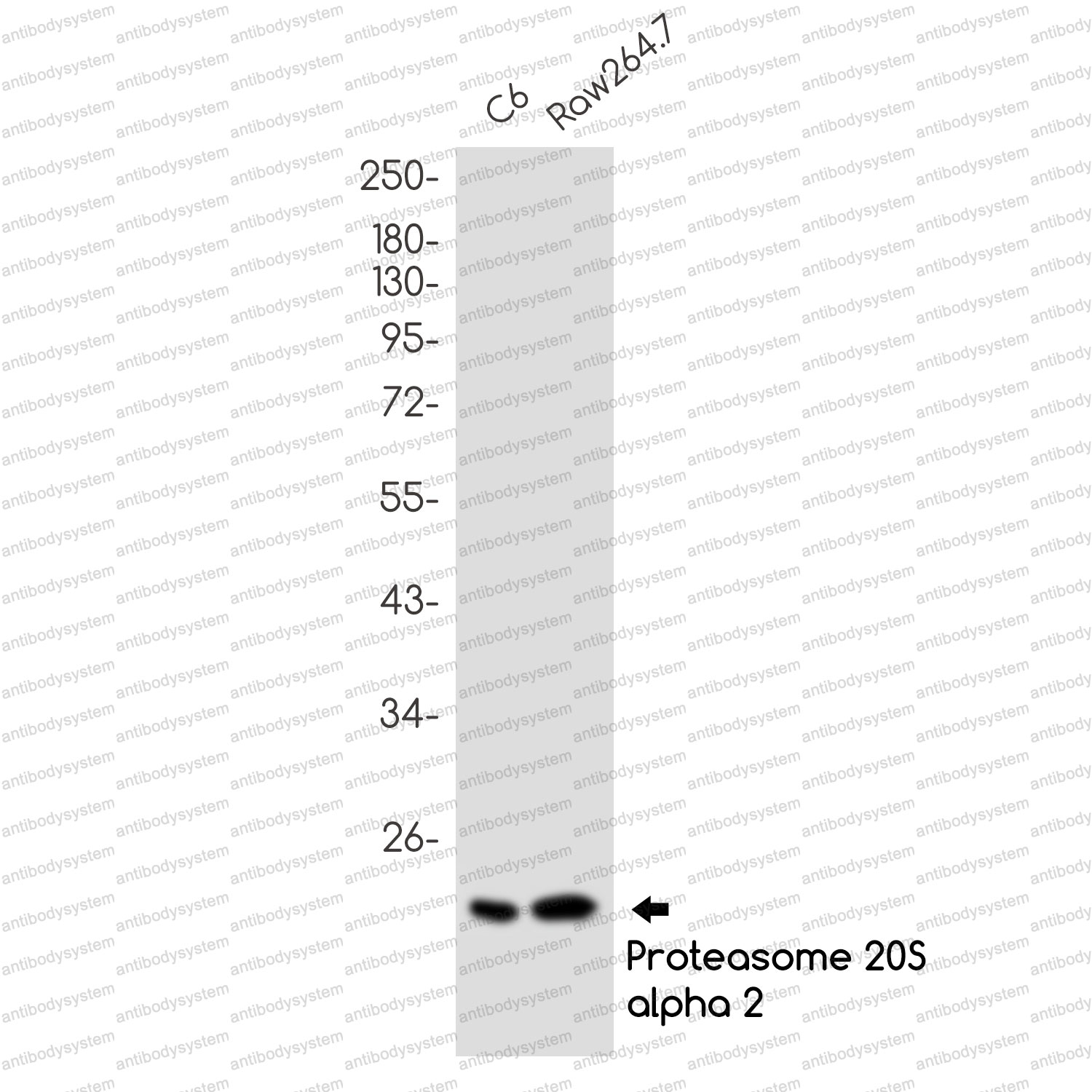 Anti-PSMB9 Antibody (R1T44)