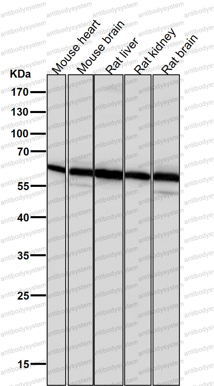 Anti-ABCD3 Antibody (R1T45)