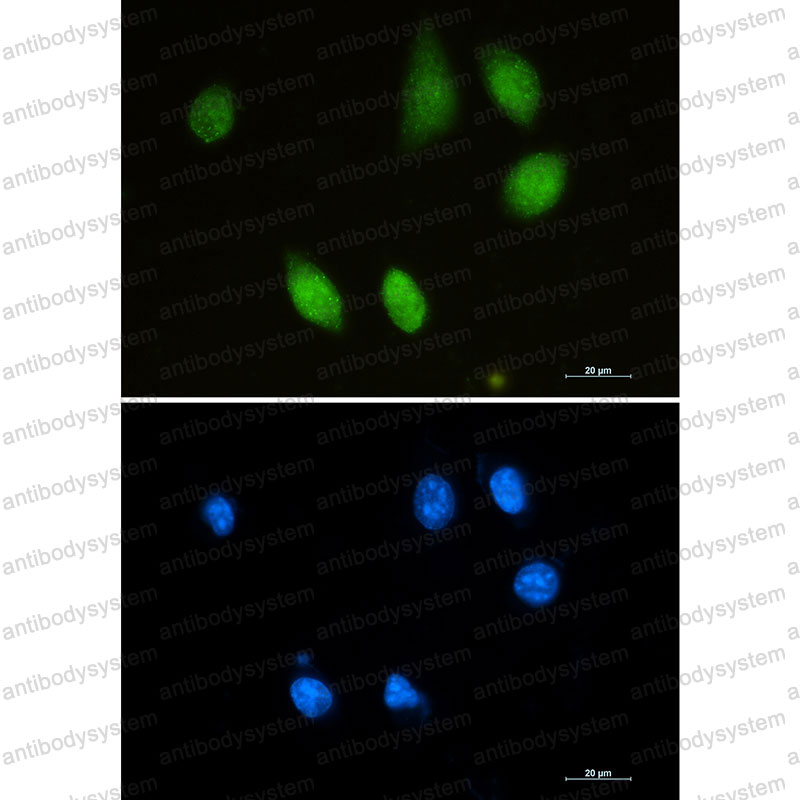 Anti-CHAT Antibody (R1T49)