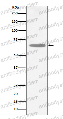 Anti-CHAT Antibody (R1T47)