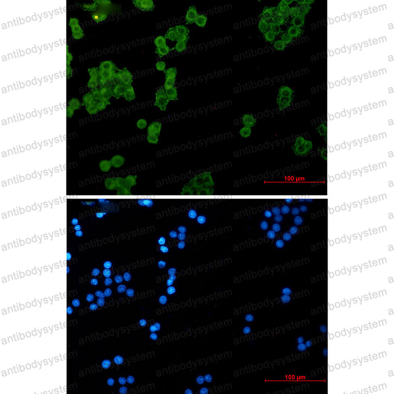 Anti-NDUFS1 Antibody (R1T51)