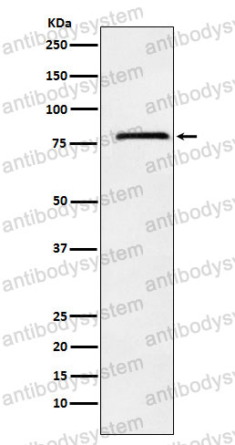 Anti-NDUFS1 Antibody (R1T50)