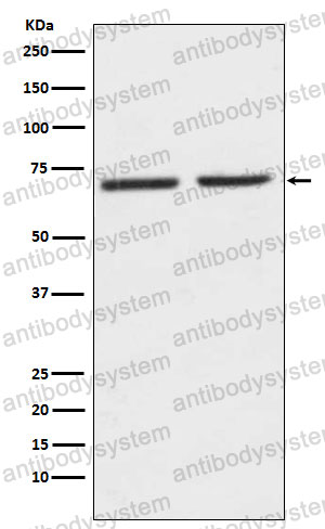 Anti-HTR2C Antibody (R1T52)
